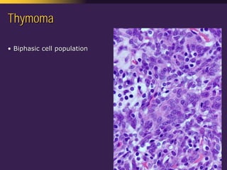 Mediastinal  Pathology  Compartmental  Approach