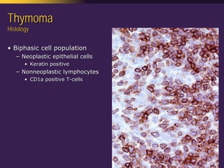 Mediastinal  Pathology  Compartmental  Approach