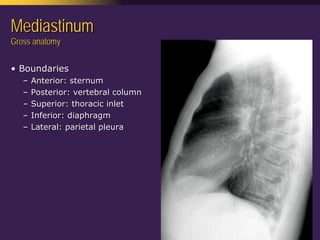 Mediastinal  Pathology  Compartmental  Approach