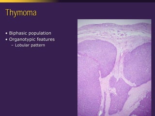 Mediastinal  Pathology  Compartmental  Approach