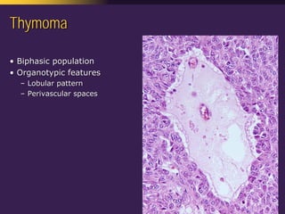 Mediastinal  Pathology  Compartmental  Approach