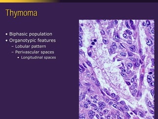 Mediastinal  Pathology  Compartmental  Approach