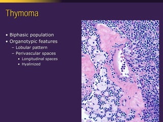Mediastinal  Pathology  Compartmental  Approach