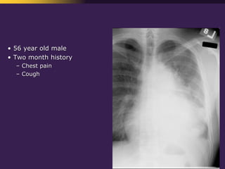 Mediastinal  Pathology  Compartmental  Approach