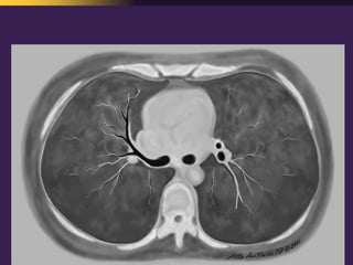 Mediastinal  Pathology  Compartmental  Approach