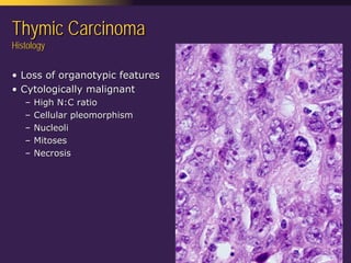 Mediastinal  Pathology  Compartmental  Approach