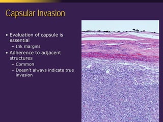 Mediastinal  Pathology  Compartmental  Approach