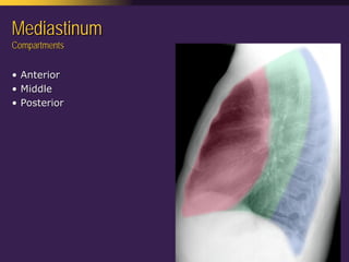 Mediastinal  Pathology  Compartmental  Approach