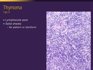 Mediastinal  Pathology  Compartmental  Approach