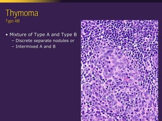 Mediastinal  Pathology  Compartmental  Approach