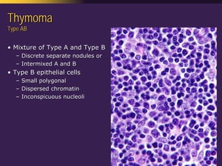 Mediastinal  Pathology  Compartmental  Approach