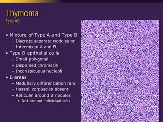 Mediastinal  Pathology  Compartmental  Approach