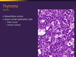 Mediastinal  Pathology  Compartmental  Approach
