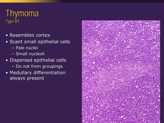 Mediastinal  Pathology  Compartmental  Approach