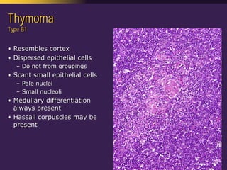Mediastinal  Pathology  Compartmental  Approach
