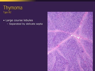 Mediastinal  Pathology  Compartmental  Approach