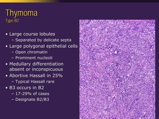 Mediastinal  Pathology  Compartmental  Approach