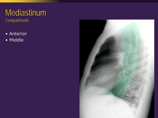 Mediastinal  Pathology  Compartmental  Approach