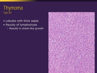 Mediastinal  Pathology  Compartmental  Approach