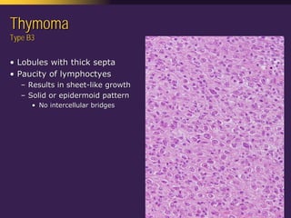 Mediastinal  Pathology  Compartmental  Approach