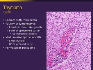Mediastinal  Pathology  Compartmental  Approach