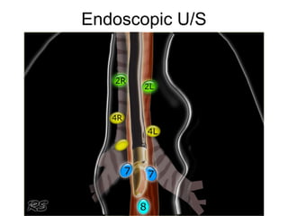 Endoscopic U/S 
 