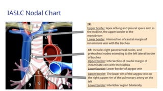 Current Evidences on Mediastinal Lymph Node Dissection for Lung Cancer ...