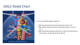 Current Evidences on Mediastinal Lymph Node Dissection for Lung Cancer ...
