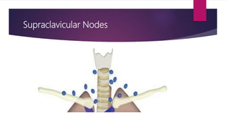 Supraclavicular Nodes
 