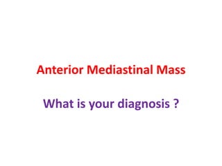 Anterior Mediastinal Mass
What is your diagnosis ?
 
