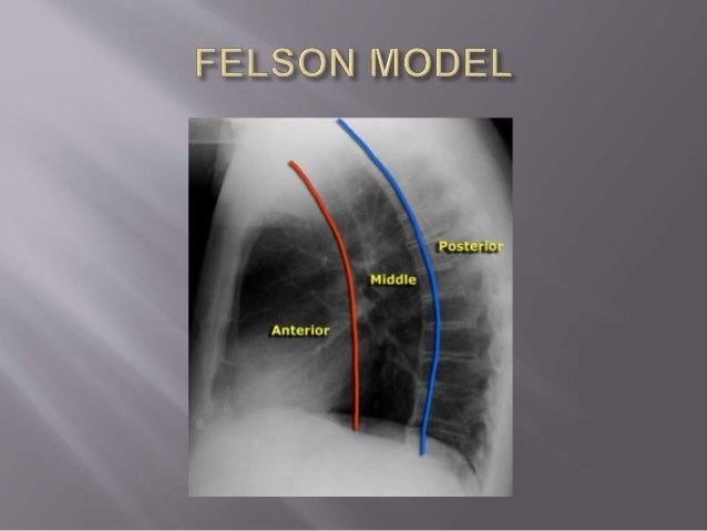 X RAY CHEST IN EVALUATION OF MEDIASTINAL MASSES