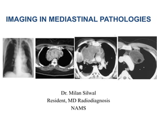 IMAGING IN MEDIASTINAL PATHOLOGIES
Dr. Milan Silwal
Resident, MD Radiodiagnosis
NAMS
 