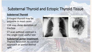 Substernal Approach Approach to Mediastinal Mass | PPTX