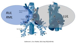 RUL
RML
2R
4R
10R
LUL
2L
4L
6
5
Volterrani L. Eur J Radiol. 2011 Sep;79(3):459-66.
 