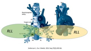 RLL
8R
RLL8L
7
Volterrani L. Eur J Radiol. 2011 Sep;79(3):459-66.
 