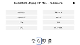 32
Mediastinal Staging with MSCT-multicriteria
Sensitivity
PPV
Specificity
NPV
94-100%
94%
98.5%
98.5-100%
 