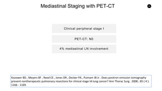 44
Mediastinal Staging with PET-CT
Clinical peripheral stage I
4% mediastinal LN involvement
PET-CT: N0
Kozower BD , Meyers BF , Reed CE , Jones DR , Decker PA , Putnam JB Jr . Does positron emission tomography
prevent nontherapeutic pulmonary resections for clinical stage IA lung cancer? Ann Thorac Surg . 2008 ; 85 ( 4 ):
1166 - 1169.
 