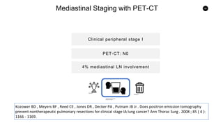 45
Mediastinal Staging with PET-CT
Clinical peripheral stage I
4% mediastinal LN involvement
PET-CT: N0
Kozower BD , Meyers BF , Reed CE , Jones DR , Decker PA , Putnam JB Jr . Does positron emission tomography
prevent nontherapeutic pulmonary resections for clinical stage IA lung cancer? Ann Thorac Surg . 2008 ; 85 ( 4 ):
1166 - 1169.
 