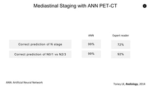 52
Mediastinal Staging with ANN PET-CT
Correct prediction of N stage
Correct prediction of N0/1 vs N2/3
99%
99%
72%
92%
ANN Expert reader
ANN: Artificial Neural Network
Toney LK, Radiology, 2014
 