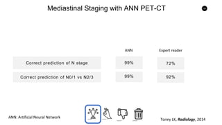 53
Mediastinal Staging with ANN PET-CT
Correct prediction of N stage
Correct prediction of N0/1 vs N2/3
99%
99%
72%
92%
ANN Expert reader
ANN: Artificial Neural Network
Toney LK, Radiology, 2014
 