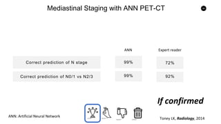 54
Mediastinal Staging with ANN PET-CT
Correct prediction of N stage
Correct prediction of N0/1 vs N2/3
99%
99%
72%
92%
ANN Expert reader
ANN: Artificial Neural Network
Toney LK, Radiology, 2014
If confirmed
 