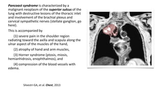 Pancoast syndrome is characterized by a
malignant neoplasm of the superior sulcus of the
lung with destructive lesions of the thoracic inlet
and involvement of the brachial plexus and
cervical sympathetic nerves (stellate ganglion, go
here).
This is accompanied by
(1) severe pain in the shoulder region
radiating toward the axilla and scapula along the
ulnar aspect of the muscles of the hand,
(2) atrophy of hand and arm muscles,
(3) Horner syndrome (ptosis, miosis,
hemianhidrosis, enophthalmos), and
(4) compression of the blood vessels with
edema.
Silvestri GA, et al. Chest, 2013
 