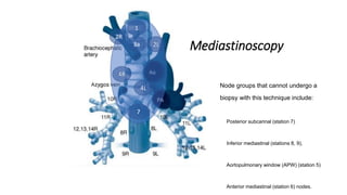 2R
4R
7
2L
4L
1
3a
Mediastinoscopy
Node groups that cannot undergo a
biopsy with this technique include:
Posterior subcarinal (station 7)
Inferior mediastinal (stations 8, 9),
Aortopulmonary window (APW) (station 5)
Anterior mediastinal (station 6) nodes.
 