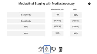 63
Mediastinal Staging with Mediastinoscopy
Sensitivity
PPV
Specificity
NPV
78%
(100%)
(100%)
91%
89%
(100%)
(100%)
92%
Mediastinoscopy VAM
 