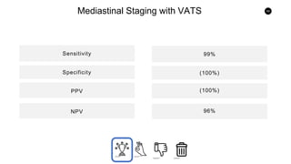 69
Mediastinal Staging with VATS
Sensitivity
PPVSpecificity
NPV
PPV
99%
(100%)
(100%)
96%
 