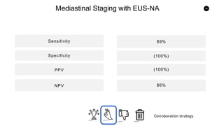 79
Mediastinal Staging with EUS-NA
Sensitivity
PPVSpecificity
NPV
PPV
89%
(100%)
(100%)
86%
Corroboration strategy
 
