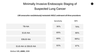 90
Minimally Invasive Endoscopic Staging of
Suspected Lung Cancer
TB-NA
PPV
EUS-NA
EUS-NA & EBUS-NA
EBUS-NA
Wallace MB, JAMA, 2008
36%
69%
69%
93%
78%
88%)
88%
97%
Sensitivity NPV
138 consecutive non(obviously) metastatic NSCLC underwent all three procedures
 