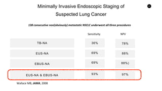 91
Minimally Invasive Endoscopic Staging of
Suspected Lung Cancer
TB-NA
PPV
EUS-NA
EUS-NA & EBUS-NA
EBUS-NA
Wallace MB, JAMA, 2008
36%
69%
69%
93%
78%
88%)
88%
97%
Sensitivity NPV
138 consecutive non(obviously) metastatic NSCLC underwent all three procedures
 