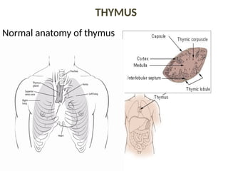 THYMUS
Normal anatomy of thymus
 