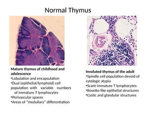 Normal Thymus
Mature thymus of childhood and
adolescence
•Lobulation and encapsulation
•Dual (epithelial/lymphoid) cell
population with variable numbers
of immature T lymphocytes
•Perivascular spaces
•Areas of “medullary” differentiation
Involuted thymus of the adult
•Spindle cell population devoid of
cytologic atypia
•Scant immature T lymphocytes
•Rosette-like epithelial structures
•Cystic and glandular structures
 